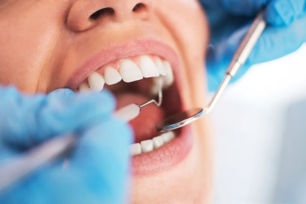 General Dentistry Prishtina