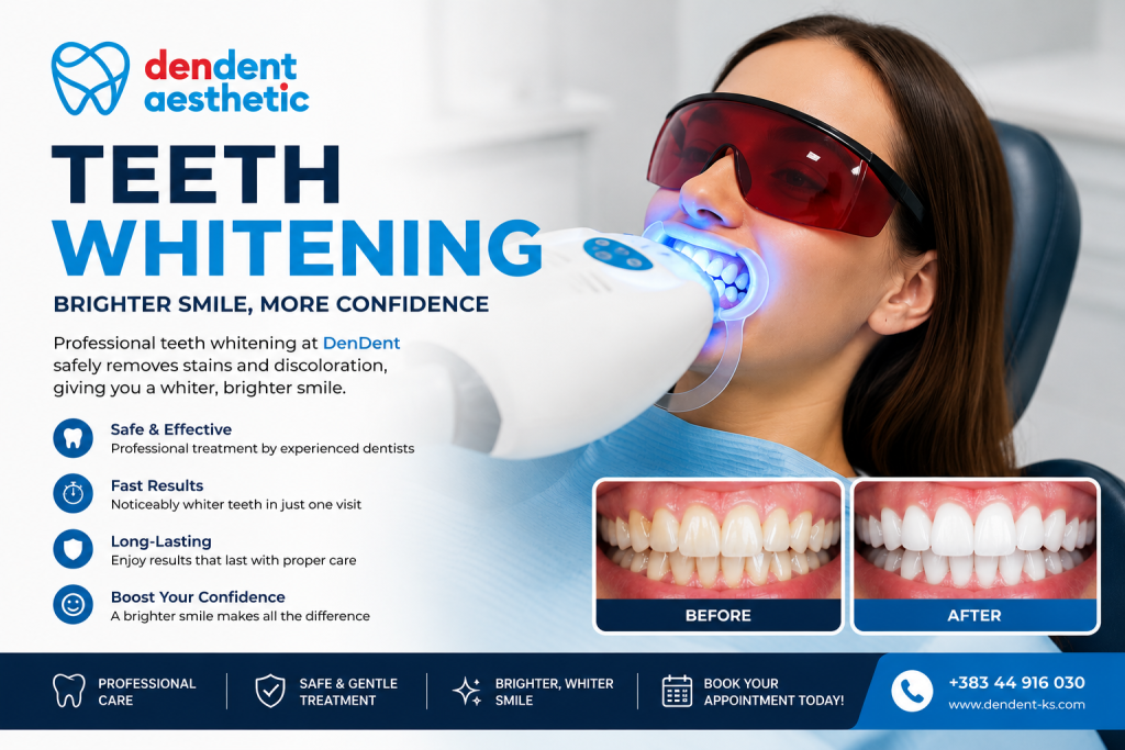 Professional teeth whitening treatment in Prishtina at DenDent